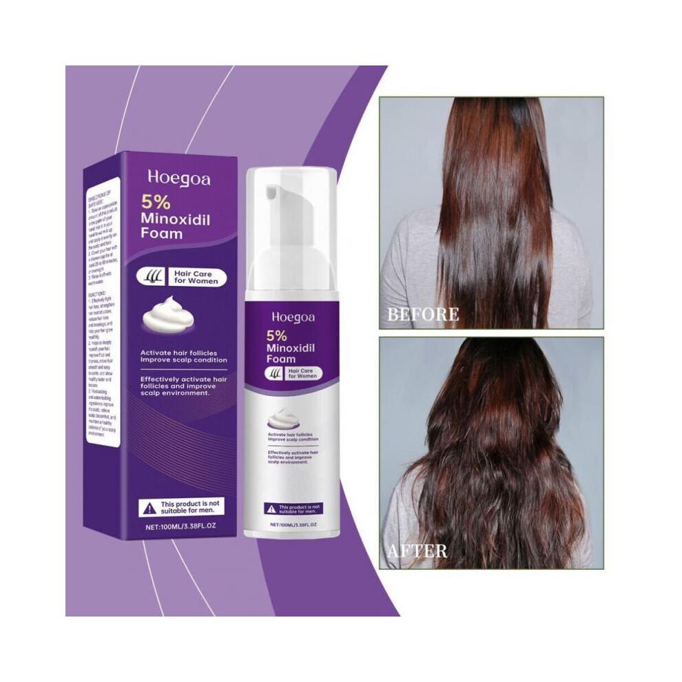 Hoegoa Minoxidil Foam