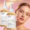 Acido Glicolico 7% Soluzione Tonificante Rimuovi Acne Skincare Viso Rassodante Idratazione Acido Glicolico Tono Delicato Tonico Esfoliante 1/2pz