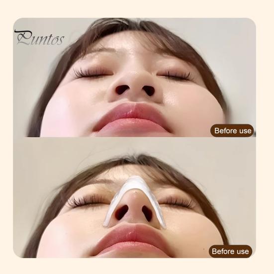 1/2ks termoplastické nosní dlahy Lichoběžníková nosní ortéza Externí nosní podpora pro operaci zlomeniny Rhinoplastika ORL imobilizace
