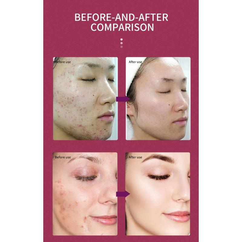 Fruit Acid Essence Hydrating and Moisturizing Facial Essence Solution