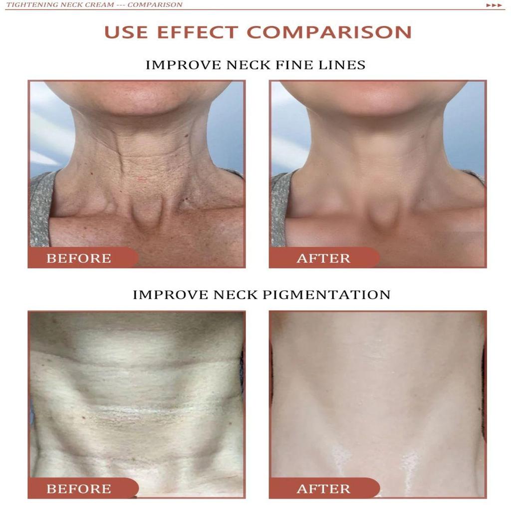 Skincare Moisturizing Cream, Quickly and Effectively Fades Skin Tone, Moisturizes and Nourishes the Body Moisturizing Cream