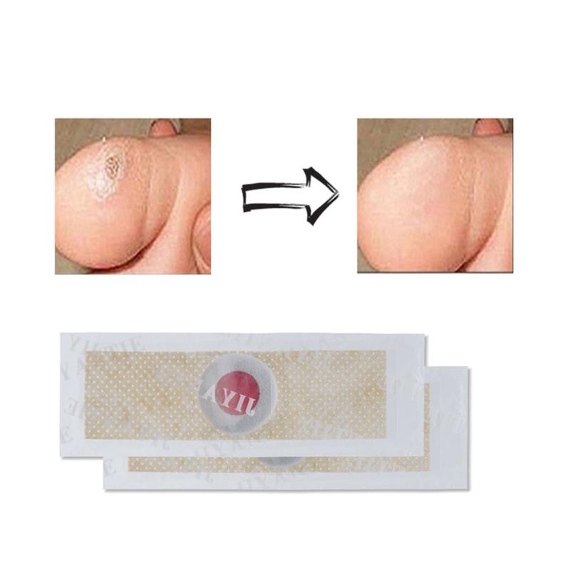 12/36Pcs Foot Medical Corn Remover Plaster Patch Feet Callus Removal Care Tool