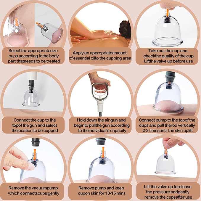 Koppesett, Koppingterapisett, 12/18/24 kopper Profesjonelt kinesisk koppesett for massasje rygg, smertelindring, fysioterapi, massasjeterapisett