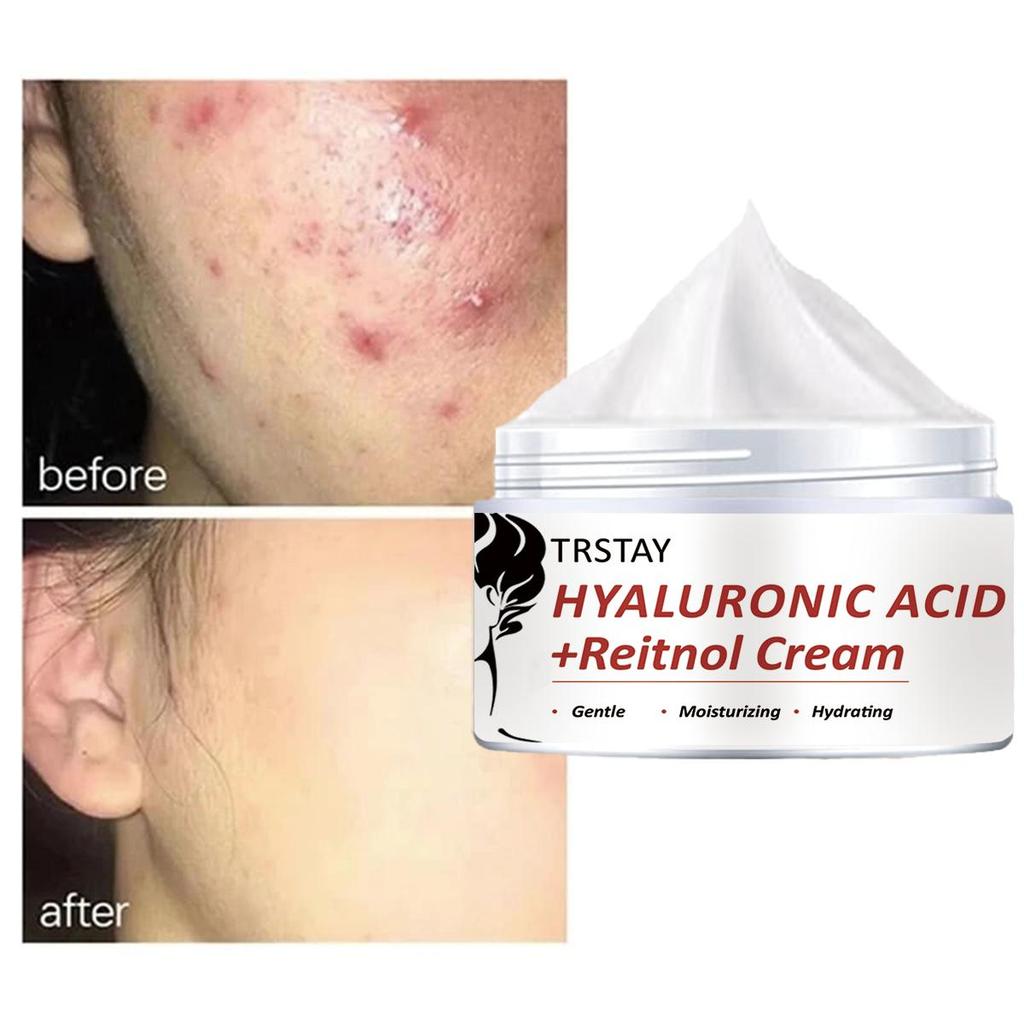 Retinol Collagen hydratační krém na obličej, mírný a nedráždivý, hydratuje a zvlhčuje pokožku