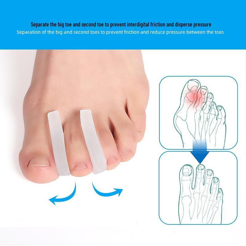 SEBS Big Toe Bunion Corrector and Hallux Valgus Straightener for Overlapping Toes