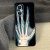 Skeleton Art Cover For OPPO Reno 8T 8 Lite 14F 13F 12 F 11 F 14 13 10 Pro OPPO Find X8 X6 X5 X9 Pro Case