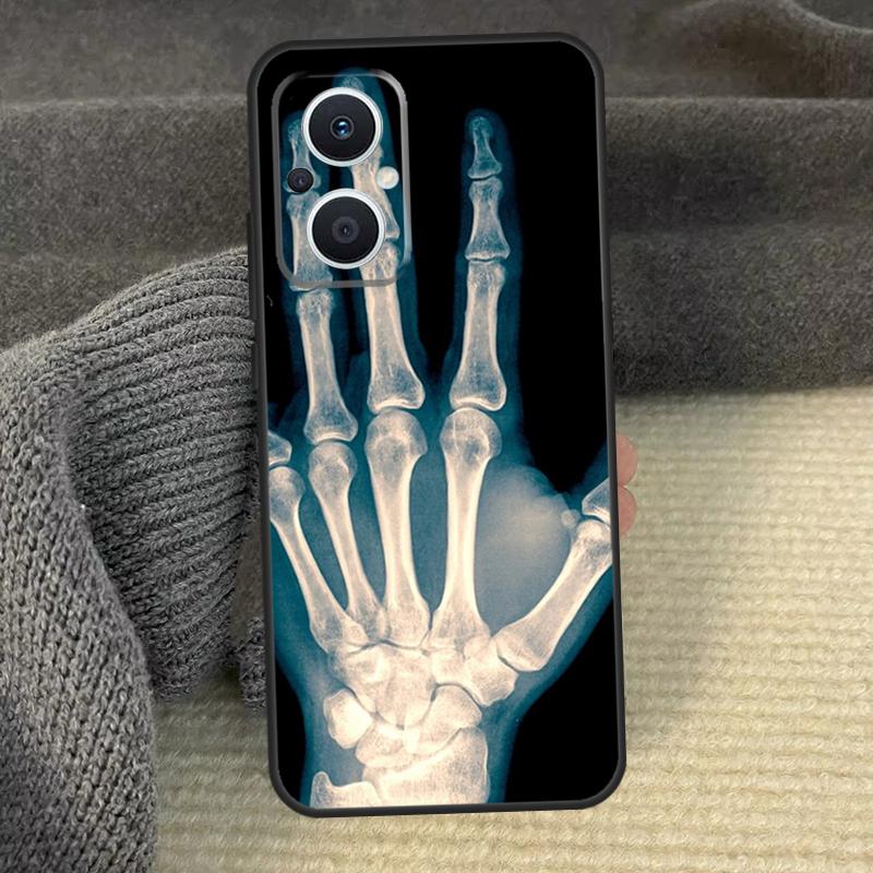 Skeleton Art Cover For OPPO Reno 8T 8 Lite 14F 13F 12 F 11 F 14 13 10 Pro OPPO Find X8 X6 X5 X9 Pro Case