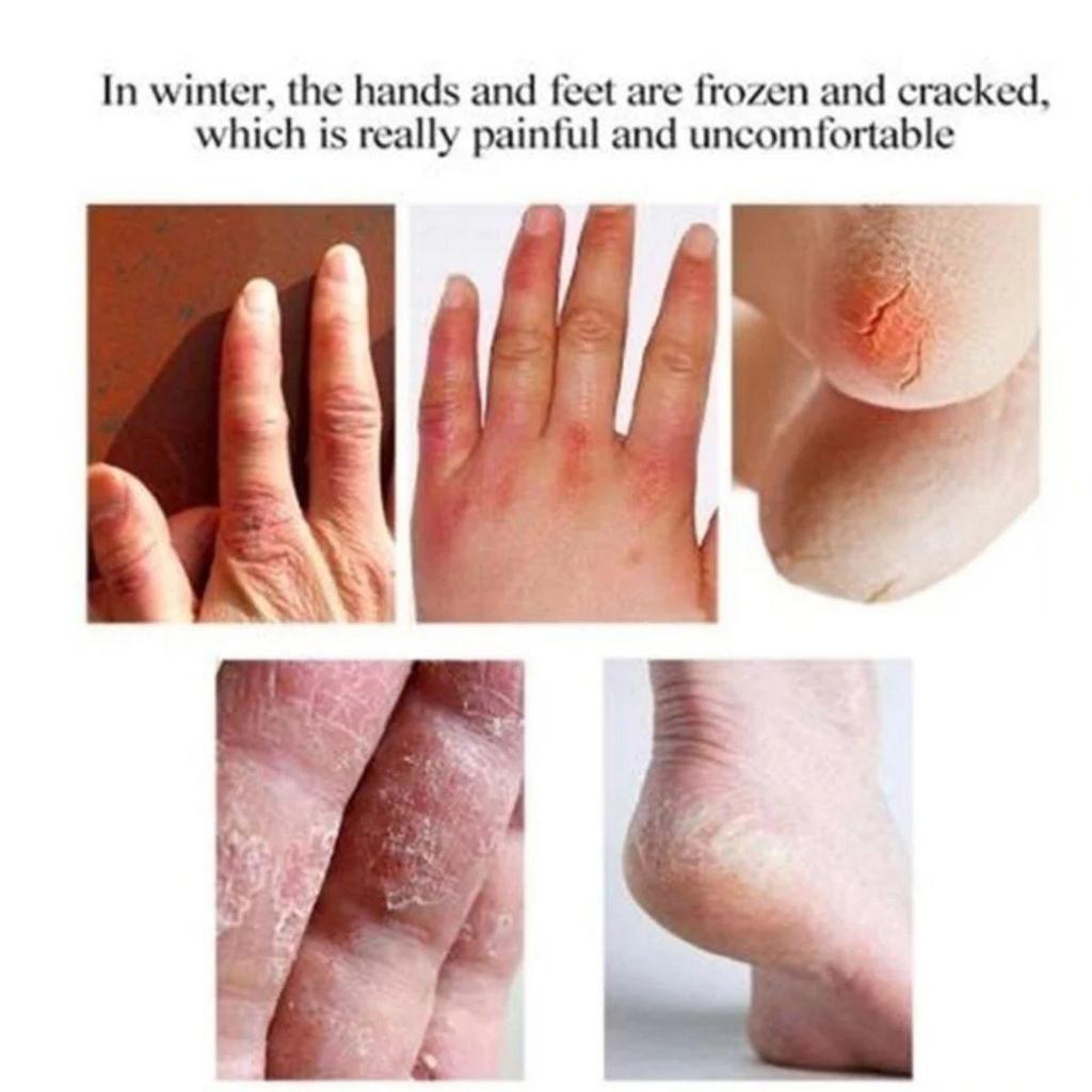 Nærende hånd- og fotmaskesett med fuktighetsgivende fotkrem, for glatt og glødende hud