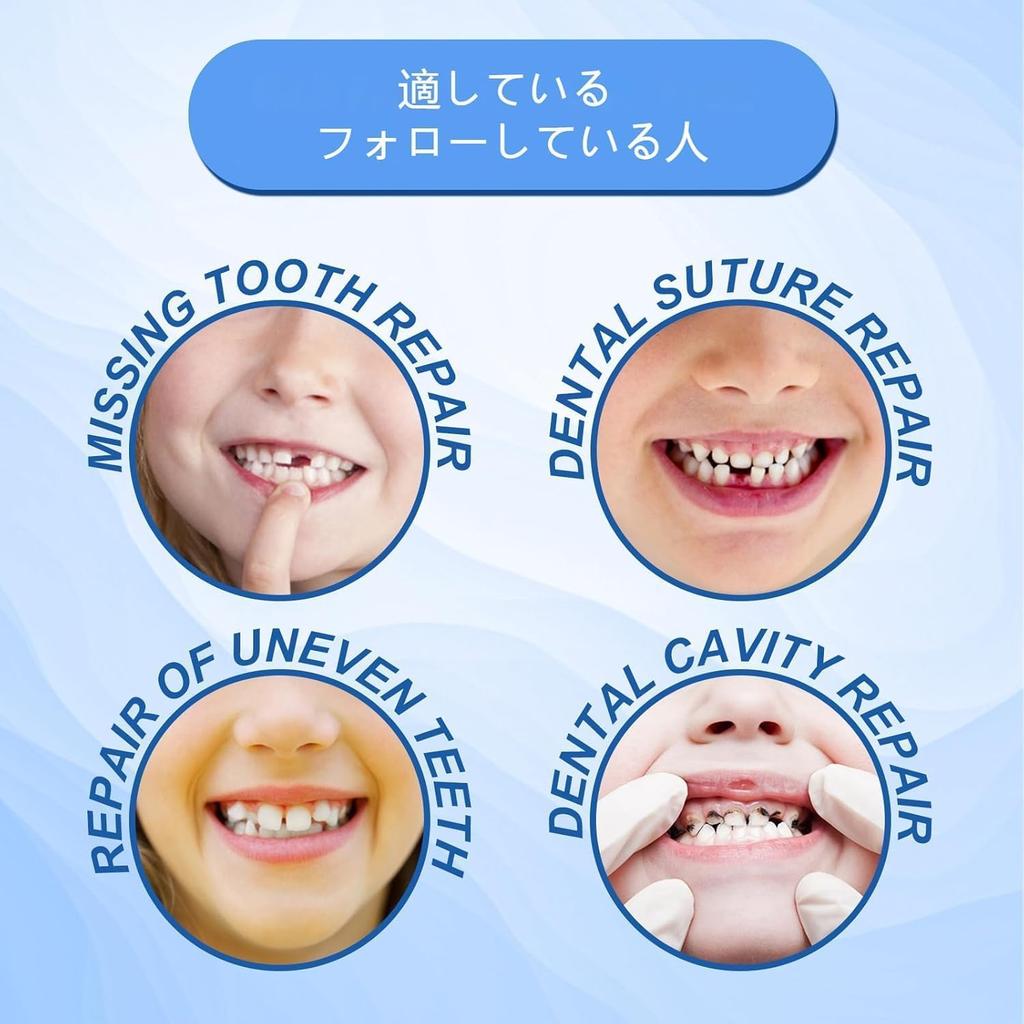 Dental Cement for Gapped Teeth, 30ml, DIY Dentures, Simple To Use, Natural Fit, Made In Germany, Removable At Any Time (1 Count)