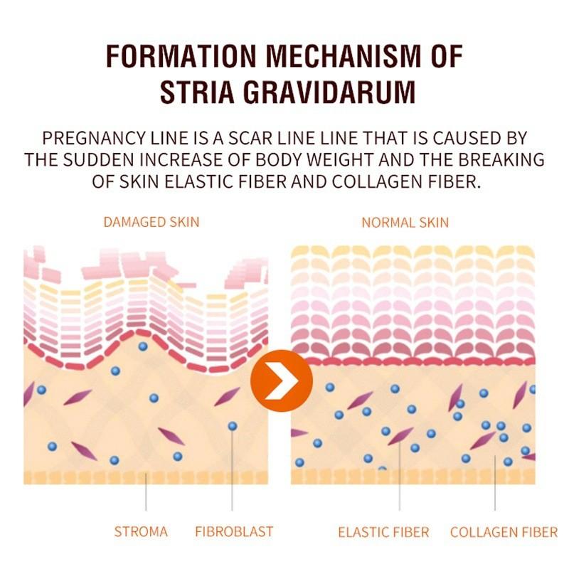 Jaysuing Skin Care Spray For Postpartum Skin Firming And Fine Line Reduction In 30ml Packaging