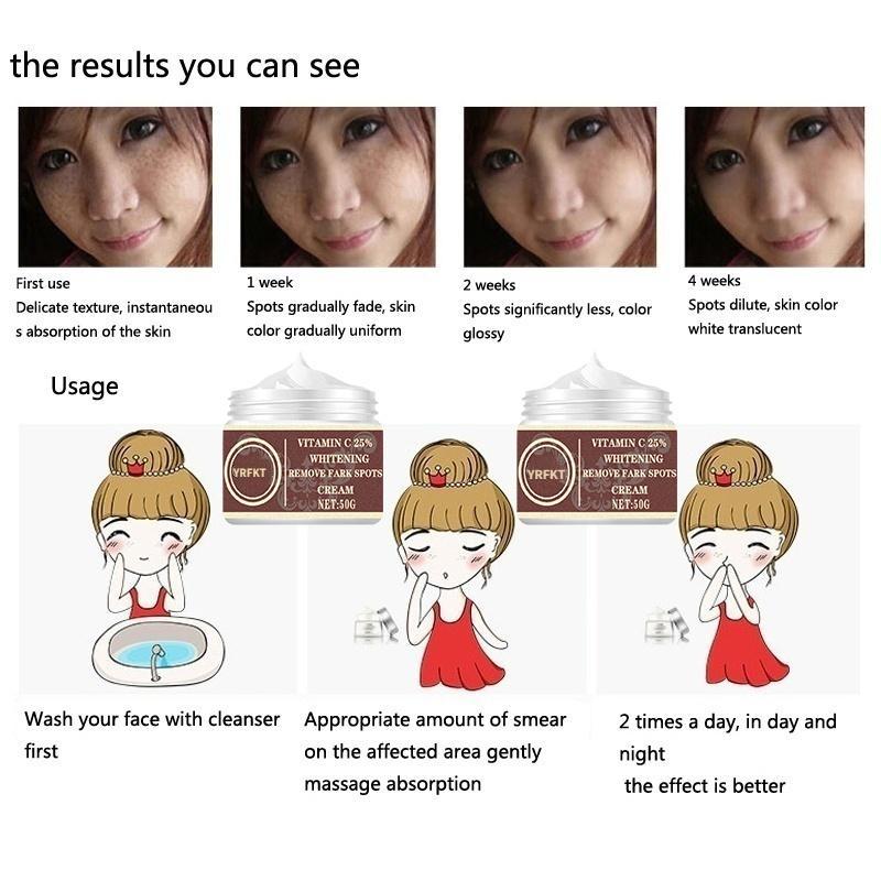 Women New Skin Brightening Cream&Freckle Cream&Dark Spot Corrector Remover for Face Blemishes