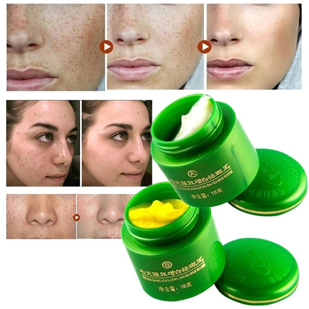 

2 шт./компл. крем для отбеливания лица, осветляющий веснушки, корректор темных пятен, удаление выцветших пятен, уход за кожей One Size