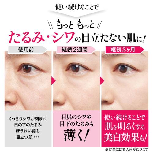 Medicated wrinkle improvement pack nasolabial folds glabellar wrinkles forehead sagging niacinamide retinol wrinkle repair na 30g