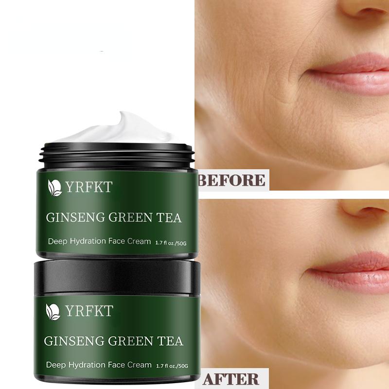 Hyaluronic Acid Essence Serum Snail Day Cream Face Cream Moisturizing Anti Aging Wrinkle Whitening Bright Face Cream