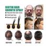 Biotin Hair Growth Spray Anti Hair Loss Fast Regrowth Scalp Treatment Serum