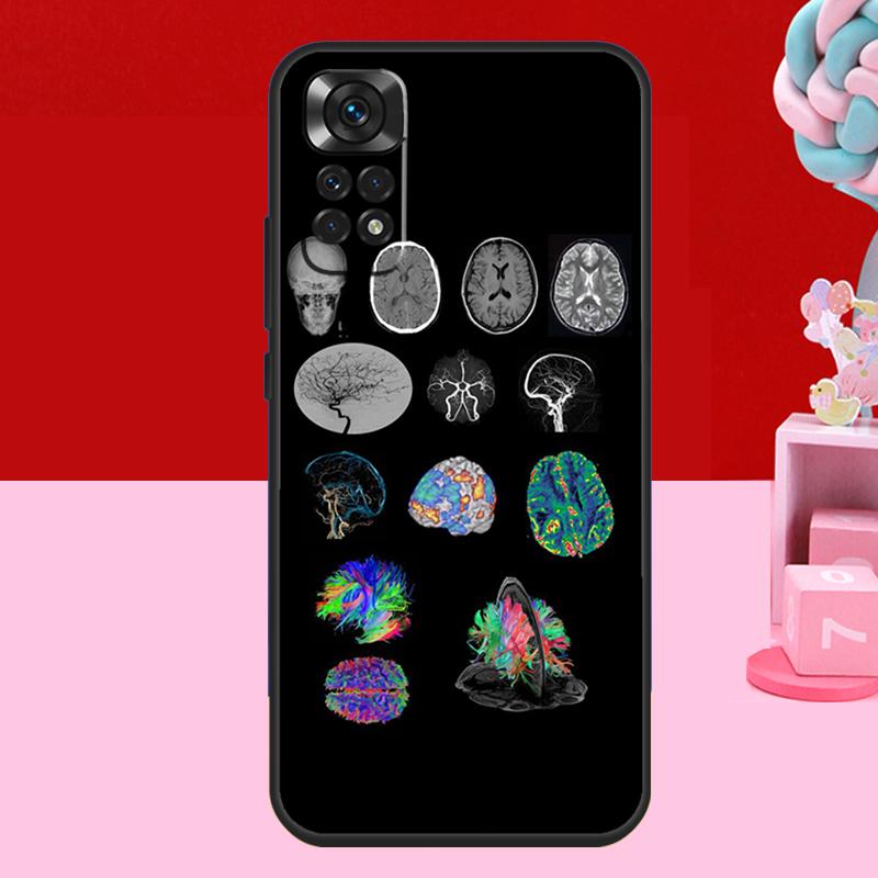 Medical Human Organs Brain Case For Xiaomi Redmi Note 14 13 12 11 10 15 Pro Plus Redmi 15 C 10C 12C 13C 14C Soft Cover