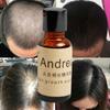 Fast Hair Growth Essentielle Herbal Keratin Andrea Alopecia Loss Liquid Ginger