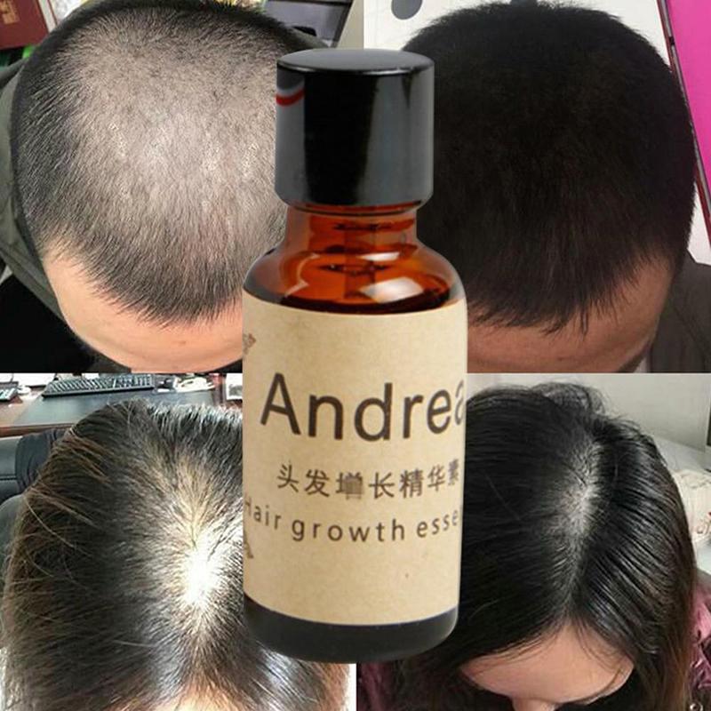 Fast Hair Growth Essentielle Herbal Keratin Andrea Alopecia Loss Liquid Ginger