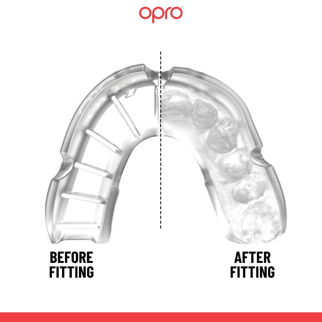 OPRO Mouth Guard Mouthpiece Sports Mouthpiece Martial Arts Dental Lab Developed Rugby Taekwondo Karate Made in the UK Equipped with unique fitting