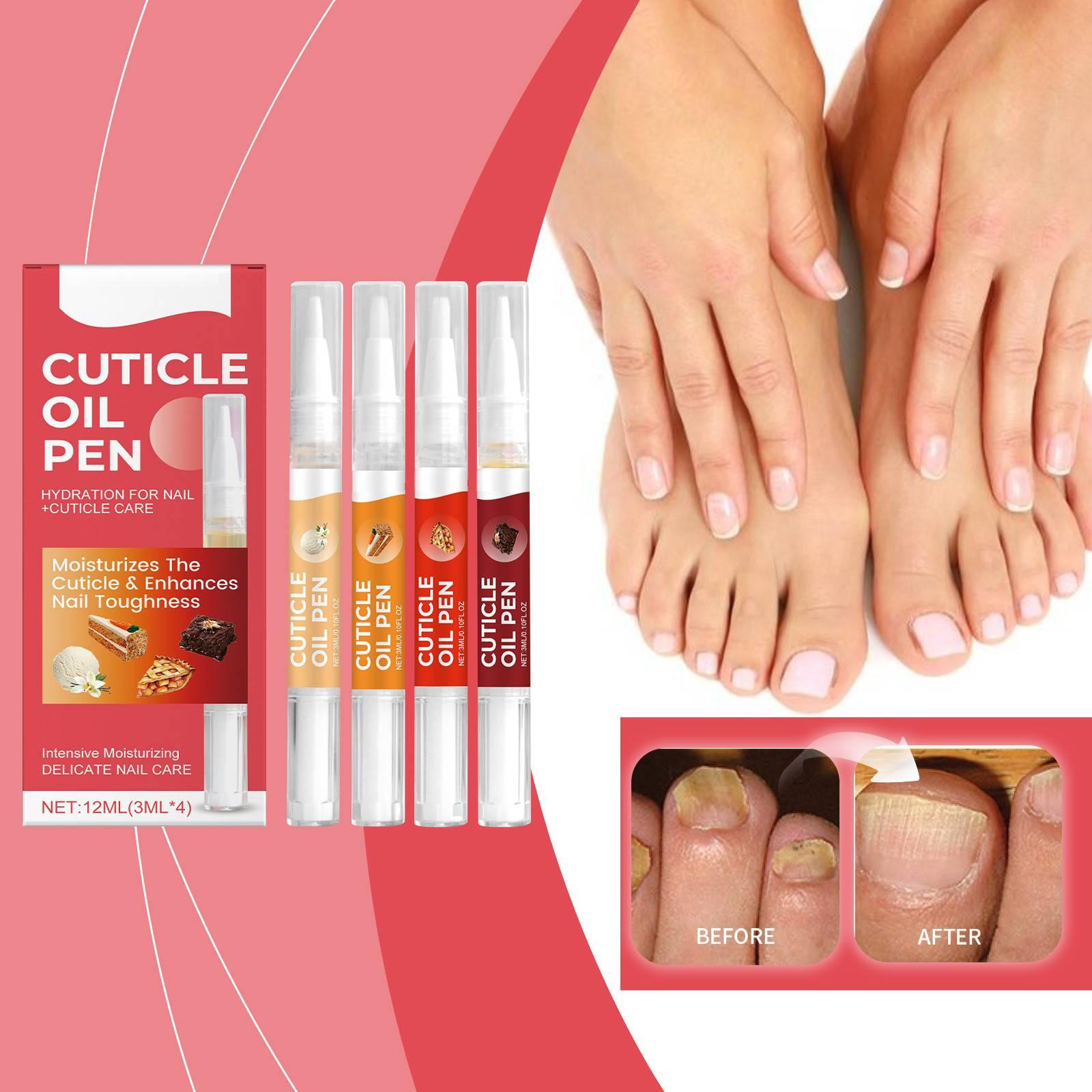 

Укрепитель для ногтей подходит для ломких ногтей, укрепляет структуру ногтей, помогает уменьшить ломкость и шелушение, а также повышает прочность ногтей3 мл*4 красный