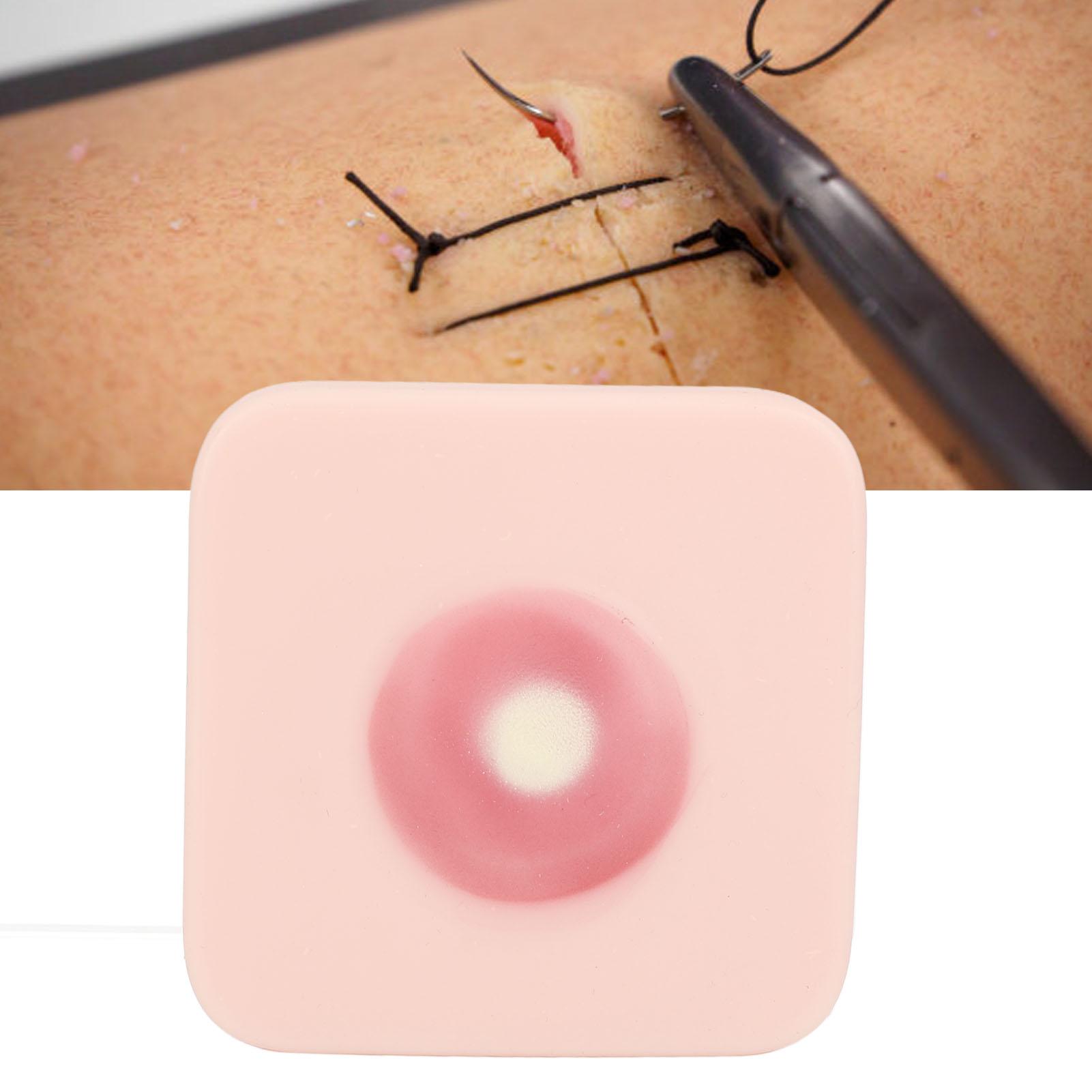 Дренажный подушечка для разреза абсцесса — фото 11