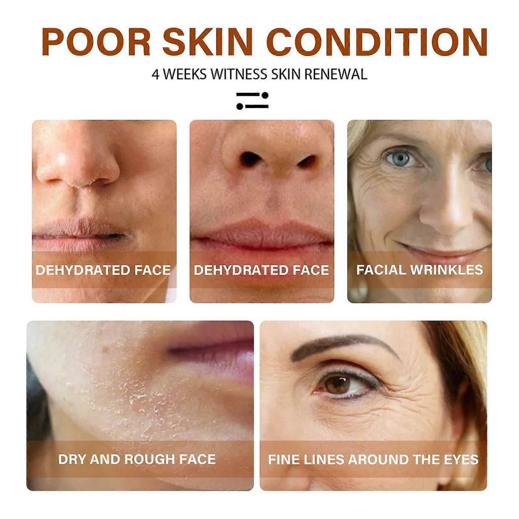 Eelhoe Retinol Facial Serum Gentle And Moisturizing, Hydrates, Tightens Pores, And Evens Skin Tone Facial Essence