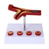 Pvc Cardiovasculair Model Wetenschap Atherosclerose Display Ziekenhuis Lesmateriaal Anatomische Modellen Fysiologie