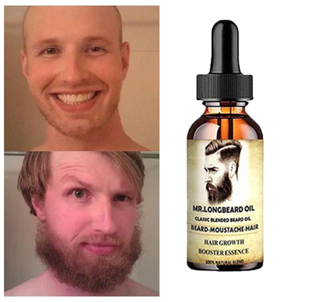 Remove Men's Facial Stubble, Fade Beard, Cheeks, and Lip Hair