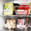 Transparent Refrigerator Storage Box Set
