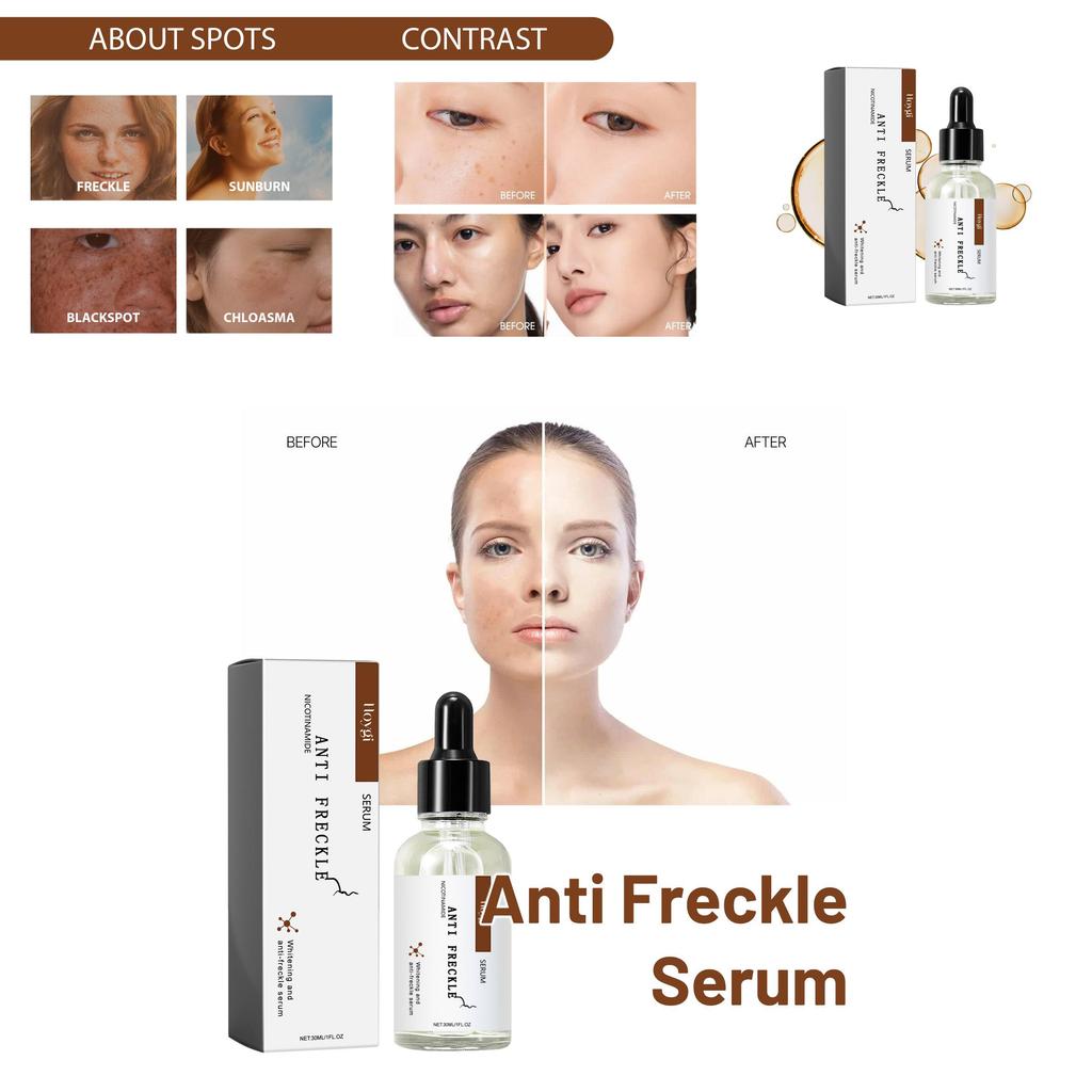 Hoygi Niacinamide Spot Brightening Serum Hydrating And Nourishing Skin Treatment For Dark Spots And Dull Complexion