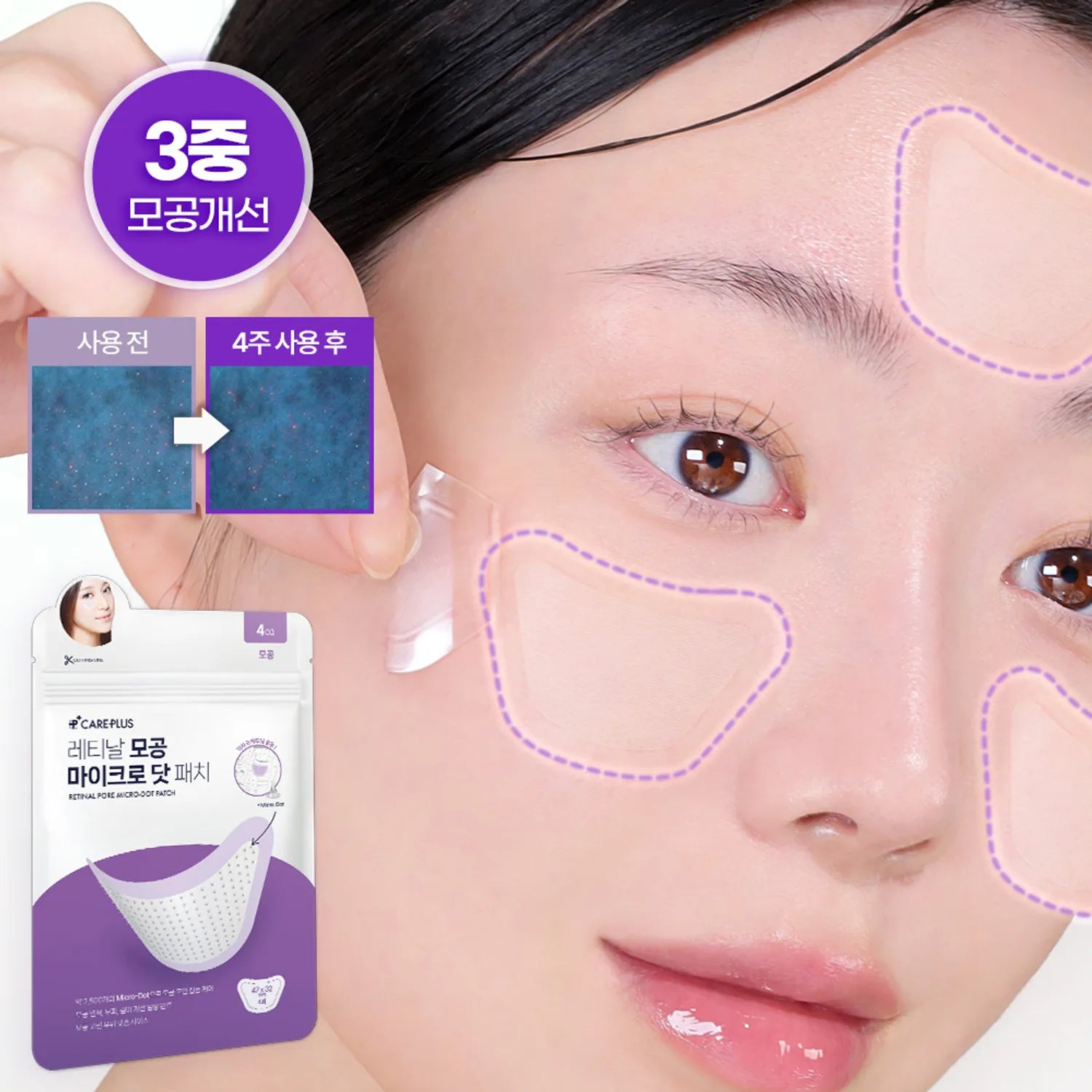 CAREPLUS Retinal Pore Micro-Dot Patch 4P 4P