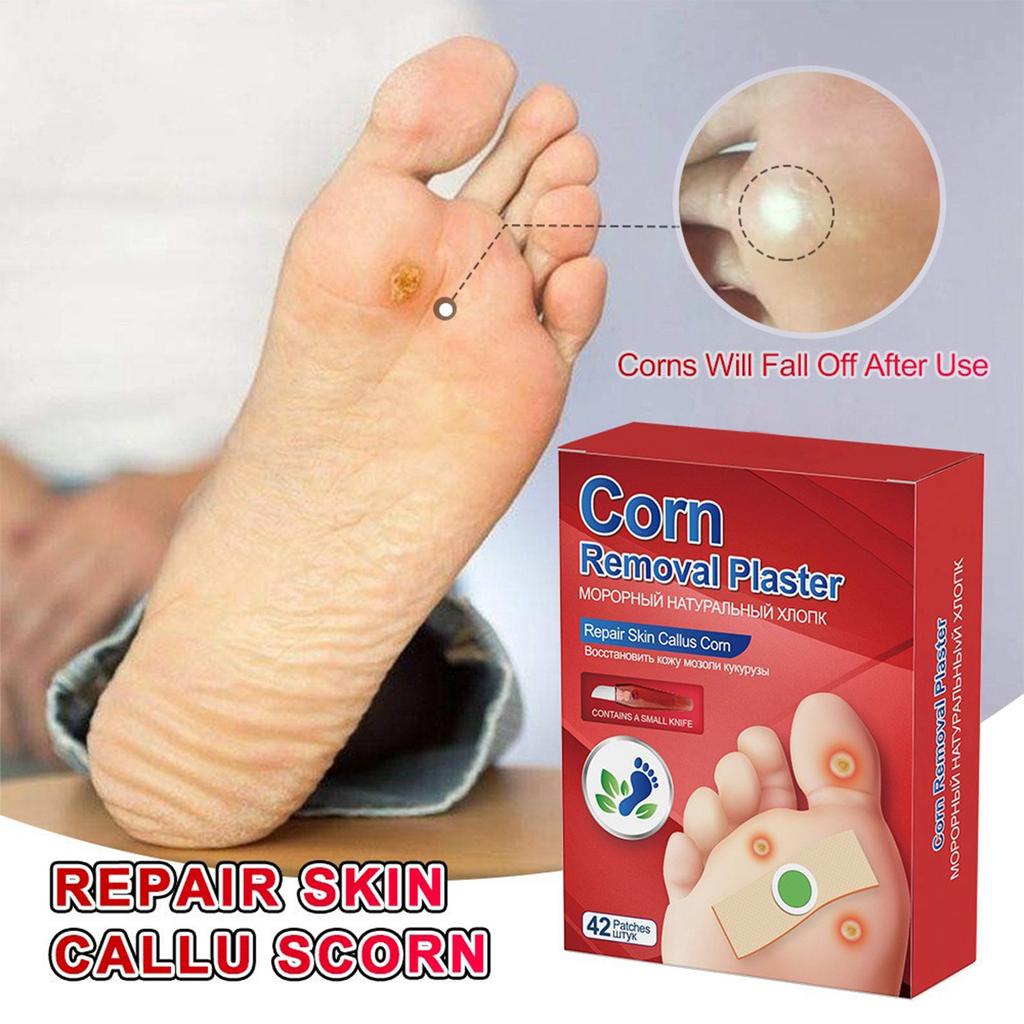 Corns Patch Reduces Corns, Calluses, Spines, Plantar s, Corns Ointment, Corns Ointment, Toe Corns Remover, Foot Calluses Health Patch.