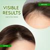 Jovees Herbal Rosemary Water Hair Care Mist Spray with Follicusan DP 200 Ml Scalp Nourishing Non Greasy Hair Tonic