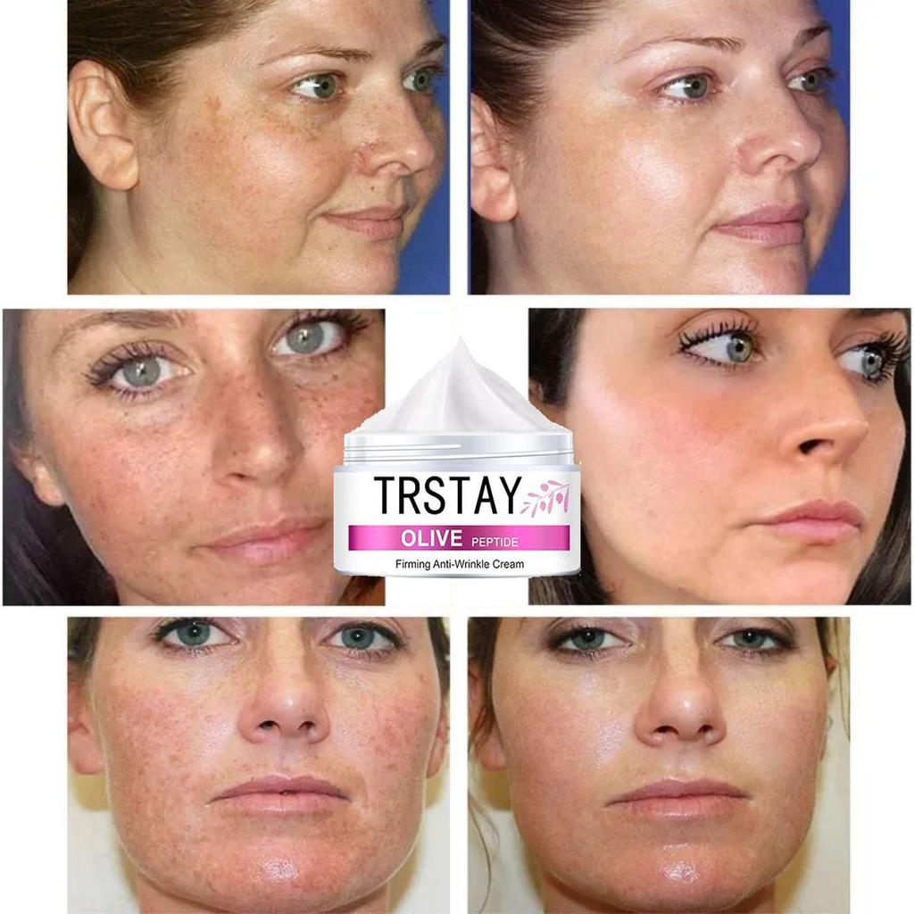 Facial whitening hyaluronic acid moisturizing serum, deep care and anti-wrinkle