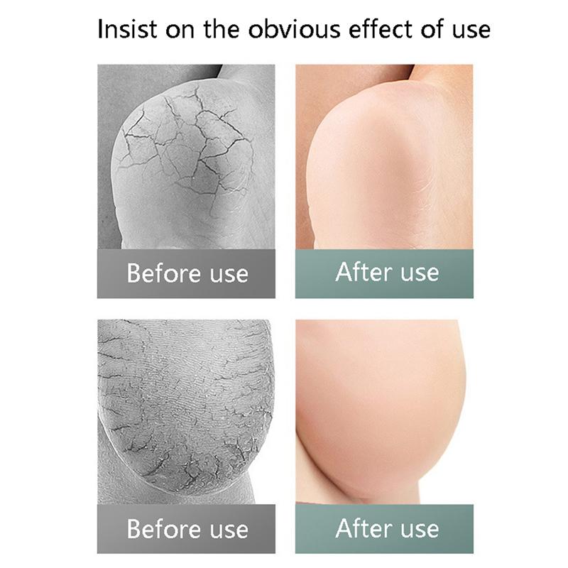 Fersen Socken Silikon Anti-Riss Schuhpolster Unisex Schmerzlinderung Fußpflege Socke