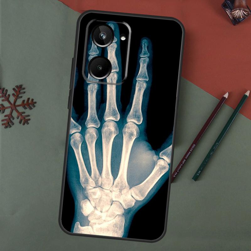 Skeleton Art Case For Realme 15 Pro GT7 GT6 C65 C67 C61 C53 C55 C51 C35 C63 C71 C75 11 12 13 14 Pro Plus