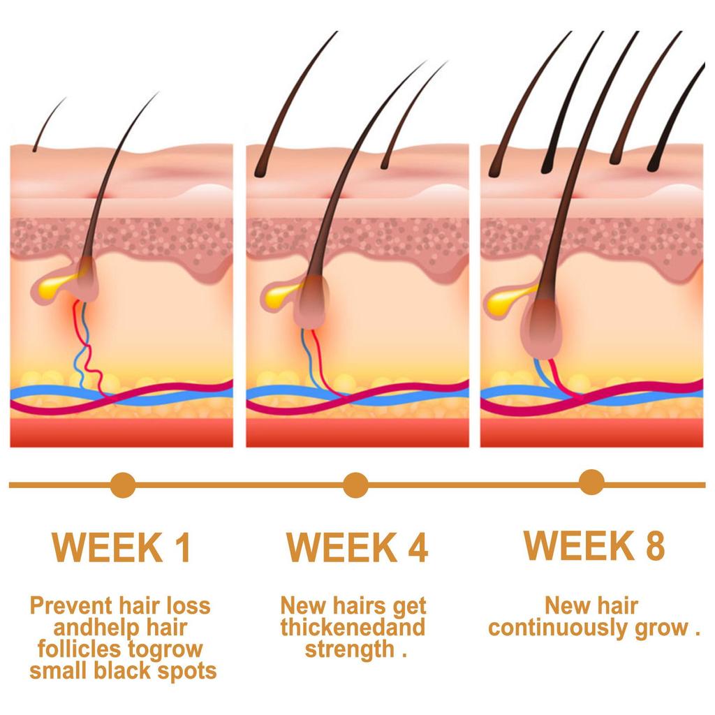 EELHOE Rice Water Hair Oil, Repair for Permed and Dyed Damage, Improves Dry and Frizzy Hair, Moisturizing and Softening Hair Essence 30ml