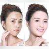Protein Thread Lifting Anti-Wrinkle Gold Essence Combination Facial Lift Woman Golden Thread Carving Protein Thread Essence