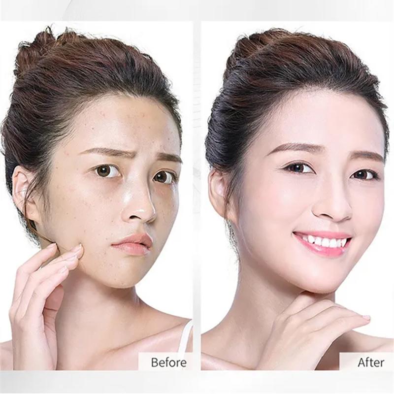 Protein Thread Lifting Anti-Wrinkle Gold Essence Combination Facial Lift Woman Golden Thread Carving Protein Thread Essence