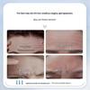 DO Vitamin E Forehead Anti-Wrinkle Cream: Firms, Moisturizes, Smoothens, and Hydrates Skin.