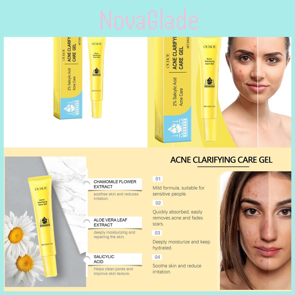 Ouhoe Acne Gel For Deep Cleansing And Brightening Skin With Pore Minimizing Formula 20g