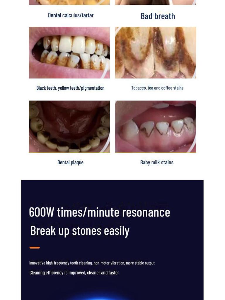 Electric Ultrasonic Tooth Cleaner: Removes Tartar, Smoke Stains, Polishes, and Beautifies Teeth.