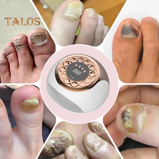 UV LED Nail Light Nail Fungus Treatment Device 650nm Infrared Light 470nm Blue Light Toenail Fingernail Onychomycosis Removal Gel Polish Drying