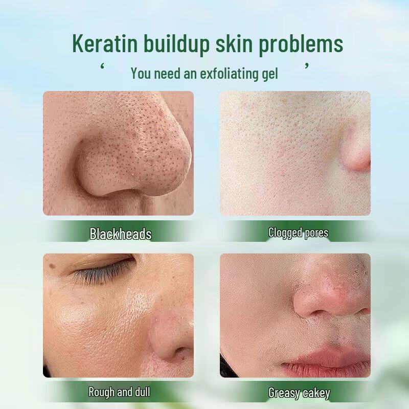 Shi Dan Ya Aloe Vera Exfoliating Gel