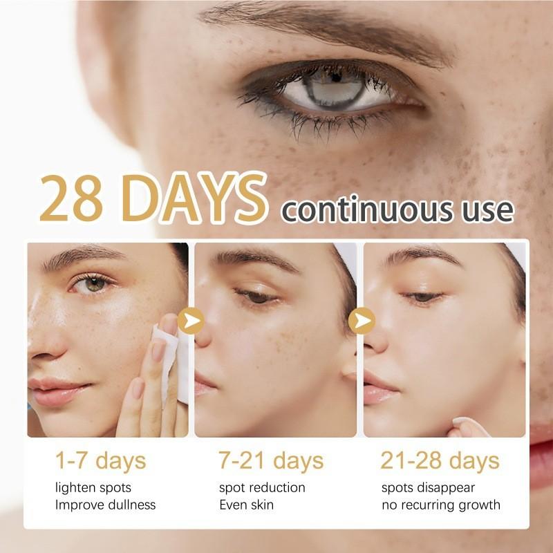 Eelhoe Brightening Cream With Bearberry Extract For Moisturizing And Spot Reduction