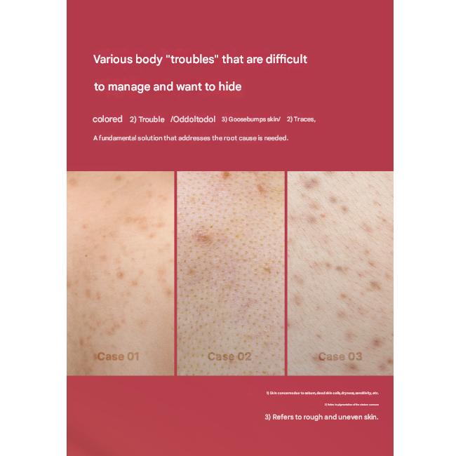 Medicube Body Pigmentation Intensive Care Set (Red Acne Body Peeling Shot 110g / Red Clear Capsule Body Lotion 230ml) (7 Options)