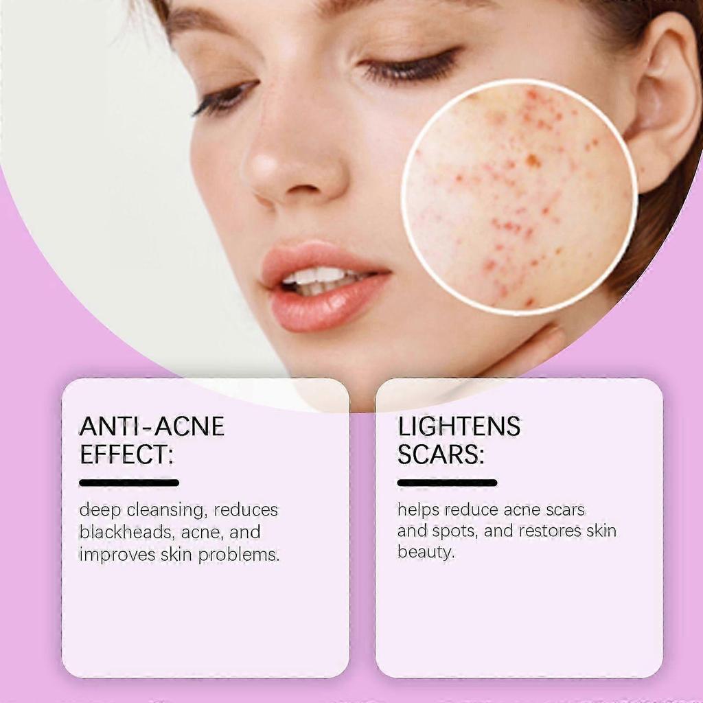 2025 Latest Model  Azelaic Acid Anti-Acne Repair Cream To Reduce Acne And Improve Redness