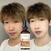 Facial Serum Antioxidant Whitening&Brightening Essential Oil Collagen Vitamin Skin Nourishing&Moisturizing Essence