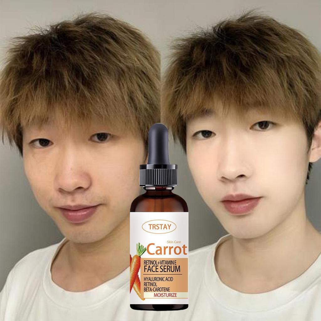 Facial Serum Antioxidant Whitening&Brightening Essential Oil Collagen Vitamin Skin Nourishing&Moisturizing essence