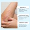 BeeAnti Fungal Cream,Fungus TreatmentCream, Itchy Skin Relief Cream,It Can  Skin Ringworm Caused By Fungal .